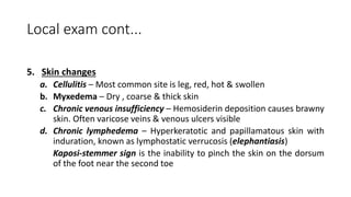 Local exam cont...
5. Skin changes
a. Cellulitis – Most common site is leg, red, hot & swollen
b. Myxedema – Dry , coarse & thick skin
c. Chronic venous insufficiency – Hemosiderin deposition causes brawny
skin. Often varicose veins & venous ulcers visible
d. Chronic lymphedema – Hyperkeratotic and papillamatous skin with
induration, known as lymphostatic verrucosis (elephantiasis)
Kaposi-stemmer sign is the inability to pinch the skin on the dorsum
of the foot near the second toe
 