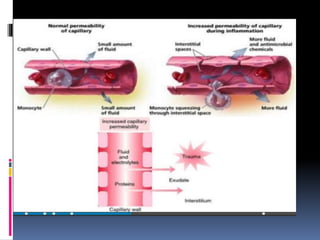 Edema | PPTX