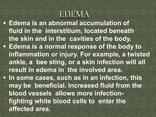  Edema is an abnormal accumulation of
fluid in the interstitium, located beneath
the skin and in the cavities of the body.
 Edema is a normal response of the body to
inflammation or injury. For example, a twisted
ankle, a bee sting, or a skin infection will all
result in edema in the involved area.
 In some cases, such as in an infection, this
may be beneficial. Increased fluid from the
blood vessels allows more infection-
fighting white blood cells to enter the
affected area.
 
