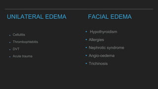 UNILATERAL EDEMA
Cellulitis
Thrombophlebitis
DVT
Acute trauma
FACIAL EDEMA
▸ Hypothyroidism
▸Allergies
▸Nephrotic syndrome
▸Angio-oedema
▸Trichinosis
 
