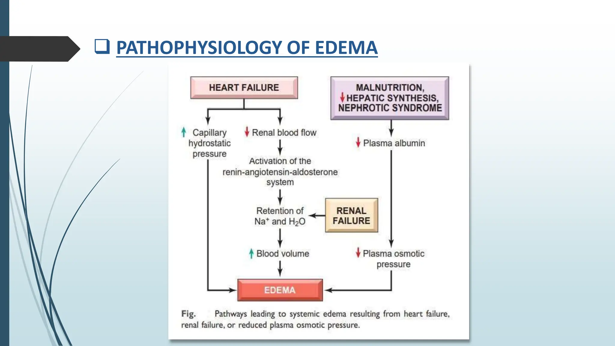  PATHOPHYSIOLOGY OF EDEMA
 