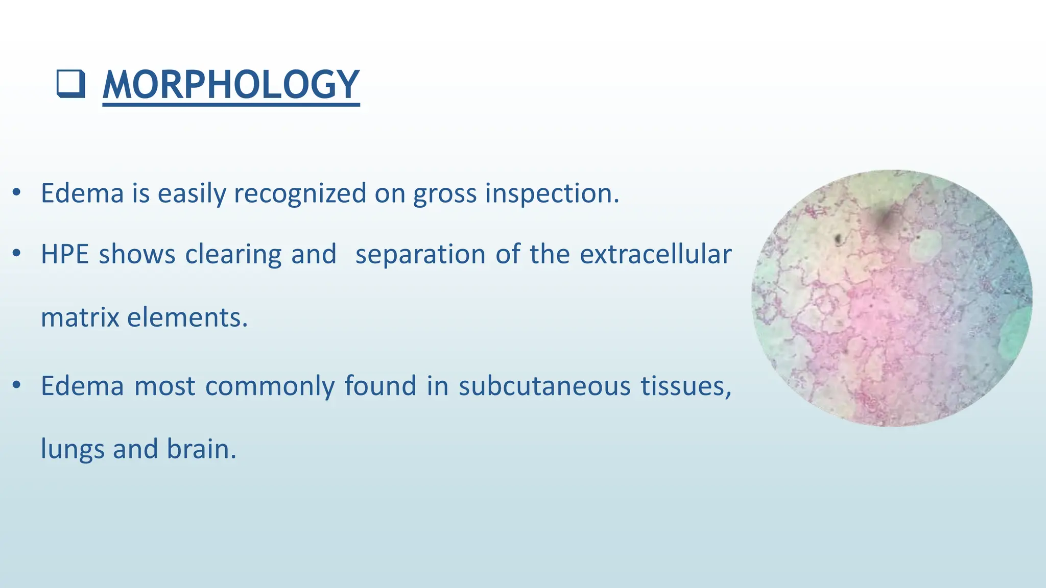  MORPHOLOGY
• Edema is easily recognized on gross inspection.
• HPE shows clearing and separation of the extracellular
matrix elements.
• Edema most commonly found in subcutaneous tissues,
lungs and brain.
 
