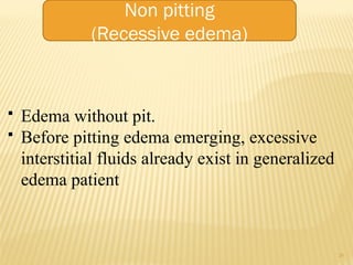 edema.ppt edema.ppt edema.ppt edema.pptedema.ppt