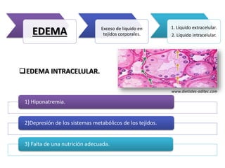 EDEMA Exceso de líquido en
tejidos corporales.
1. Líquido extracelular.
2. Líquido intracelular.
1) Hiponatremia.
2)Depresión de los sistemas metabólicos de los tejidos.
3) Falta de una nutrición adecuada.
EDEMA INTRACELULAR.
www.dietistes-aditec.com
 