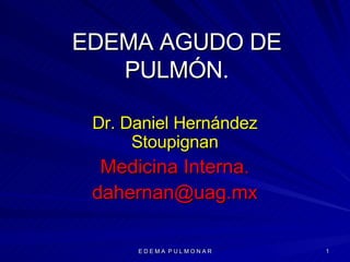 EDEMA AGUDO DE PULMÓN. Dr. Daniel Hernández Stoupignan Medicina Interna. [email_address] 