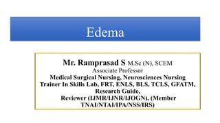 Mr. Ramprasad S M.Sc (N), SCEM
Associate Professor
Medical Surgical Nursing, Neurosciences Nursing
Trainer In Skills Lab, FRT, ENLS, BLS, TCLS, GFATM,
Research Guide,
Reviewer (IJMR/IJNR/IJOGN), (Member
TNAI/NTAI/IPA/NSS/IRS)
Edema
 
