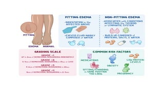 Dayspring Edema edema apresentation on edema _122548.pptx