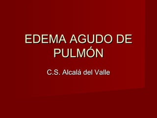 EDEMA AGUDO DEEDEMA AGUDO DE
PULMÓNPULMÓN
C.S. Alcalá del ValleC.S. Alcalá del Valle
 
