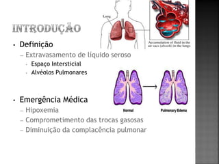 •   Definição
    –   Extravasamento de líquido seroso
        •   Espaço Intersticial
        •   Alvéolos Pulmonares



•   Emergência Médica
    –   Hipoxemia
    –   Comprometimento das trocas gasosas
    –   Diminuição da complacência pulmonar
 