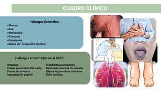 CUADRO CLÍNICO
Hallazgos Generales:
●Disnea
●Tos
●Hipoxemia
●Cianosis
●Taquipnea
●Datos de ocupación alveolar
Ortopnea
Disnea paroxística del sueño
Disnea de esfuerzo
Ingurgitación yugular
Crepitantes pulmonares
Respuesta anormal de valsalva
Edema en miembros inferiores
Dolor torácico
Hallazgos encontrados en el EAPC
 