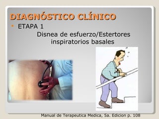 DIAGNÓSTICO CLÍNICODIAGNÓSTICO CLÍNICO
 ETAPA 1
Disnea de esfuerzo/Estertores
inspiratorios basales
Manual de Terapeutica Medica, 5a. Edicion p. 108
 