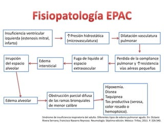↑Presión hidrostática 
(microvasculatura) 
Insuficiencia ventricular 
izquierda (estenosis mitral, 
infarto) 
Dilatación vasculatura 
pulmonar 
Perdida de la compliance 
pulmonar y ↑resistencia 
vías aéreas pequeñas 
Fuga de liquido al 
espacio 
extravascular 
Edema 
intersticial 
Irrupción 
del espacio 
alveolar 
Edema alveolar 
Obstrucción parcial difusa 
de las ramas bronquiales 
de menor calibre 
Hipoxemia. 
Disnea 
Taquipnea 
Tos productiva (serosa, 
color rosado o 
hemoptoico). 
Síndrome de insuficiencia respiratoria del adulto. Diferentes tipos de edema pulmonar agudo. En: Octavio 
Rivera Serrano, Francisco Navarro Reynoso. Neumología. Séptima edición. México: Trillas; 2011. P. 326-340. 
 