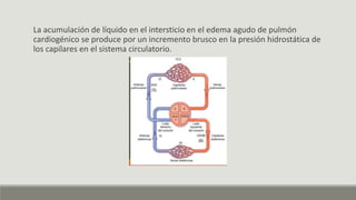La acumulación de líquido en el intersticio en el edema agudo de pulmón
cardiogénico se produce por un incremento brusco en la presión hidrostática de
los capilares en el sistema circulatorio.
 