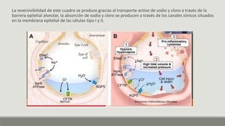 La reversivibilidad de este cuadro se produce gracias al transporte activo de sodio y cloro a través de la
barrera epitelial alveolar, la absorción de sodio y cloro se producen a través de los canales iónicos situados
en la membrana epitelial de las células tipo I y II.
 