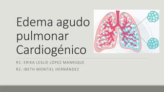 Edema agudo
pulmonar
Cardiogénico
R1: ERIKA LESLIE LÓPEZ MANRIQUE
R2: IBETH MONTIEL HERNÁNDEZ
 