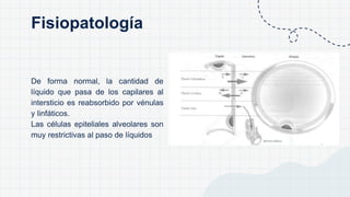 De forma normal, la cantidad de
líquido que pasa de los capilares al
intersticio es reabsorbido por vénulas
y linfáticos.
Las células epiteliales alveolares son
muy restrictivas al paso de líquidos
Fisiopatología
 