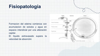 Formacion del edema comienza con
acumulacion de solutos y agua en
espacio intersticial por una alteración
capilar.
El líquido extravasado supera la
velocidad de absorción
Fisiopatología
 