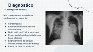 1.- Radiografia de torax
Nos puede orientar a un edema
cardiogénico en casos de:
● Cardiomegalia
● Ensanchamiento del pedículo
vascular hiliar
● Distribución en lóbulos superiores
● Líneas septales (atelectasia laminar
basal bilateral)
● Engrosamiento de tabiques
interlobulillares (lineas de Kerley)
● Patrón de “alas de mariposa”
Diagnóstico
 