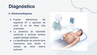 2.- Electrocardiograma
● Evaluar alteraciones del
segmento ST o aparición de
onda Q en las fases más
avanzadas.
● La presencia de hipertrofia
ventricular o auricular también
sugiere etiología cardiaca
● La identificación de arritmia tiene
importancia para decidir el
manejo de dicho edema
pulmonar
Diagnóstico
 