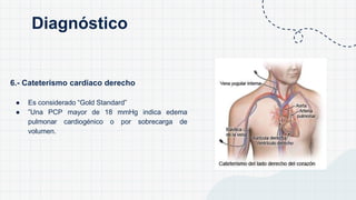 6.- Cateterismo cardiaco derecho
● Es considerado “Gold Standard”
● ”Una PCP mayor de 18 mmHg indica edema
pulmonar cardiogénico o por sobrecarga de
volumen.
Diagnóstico
 