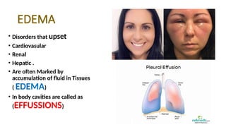 EDEMA
• Disorders that upset
• Cardiovasular
• Renal
• Hepatic .
• Are often Marked by
accumulation of fluid in Tissues
( EDEMA)
• In body cavities are called as
(EFFUSSIONS)
 