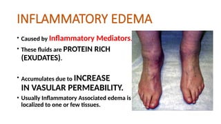 INFLAMMATORY EDEMA
• Caused by Inflammatory Mediators.
• These fluids are PROTEIN RICH
(EXUDATES).
• Accumulates due to INCREASE
IN VASULAR PERMEABILITY.
• Usually Inflammatory Associated edema is
localized to one or few tissues.
 