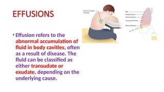 EFFUSIONS
• Effusion refers to the
abnormal accumulation of
fluid in body cavities, often
as a result of disease. The
fluid can be classified as
either transudate or
exudate, depending on the
underlying cause.
 