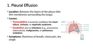 1. Pleural Effusion
• Location: Between the layers of the pleura (the
thin membranes surrounding the lungs).
• Causes:
• Transudative: Caused by conditions like heart
failure, cirrhosis, or nephrotic syndrome.
• Exudative: Due to infections (e.g., pneumonia,
tuberculosis), malignancies, or pulmonary
embolism.
• Symptoms: Shortness of breath, chest pain, dry
cough.
 