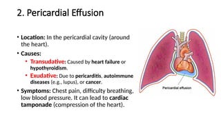 2. Pericardial Effusion
• Location: In the pericardial cavity (around
the heart).
• Causes:
• Transudative: Caused by heart failure or
hypothyroidism.
• Exudative: Due to pericarditis, autoimmune
diseases (e.g., lupus), or cancer.
• Symptoms: Chest pain, difficulty breathing,
low blood pressure. It can lead to cardiac
tamponade (compression of the heart).
 