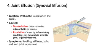 4. Joint Effusion (Synovial Effusion)
• Location: Within the joints (often the
knee).
• Causes:
• Transudative: Often related to
osteoarthritis or trauma.
• Exudative: Caused by inflammatory
conditions like rheumatoid arthritis,
gout, or joint infections.
• Symptoms: Swelling, stiffness, pain,
reduced joint movement.
 