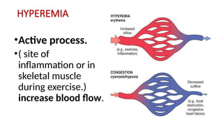 HYPEREMIA
•Active process.
•( site of
inflammation or in
skeletal muscle
during exercise.)
increase blood flow.
 