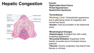 Hepatic Congestion Causes:
•Right-sided Heart Failure
•Portal Hypertension
•Budd-Chiari Syndrome
•Terms/Names:
•Nutmeg Liver: Characteristic appearance
due to alternating zones of congestion and
normal liver tissue.
•Ascites: Fluid accumulation in the abdominal
cavity.
•Morphological Changes:
•Hepatomegaly: Enlarged liver with a dark,
congested appearance.
•Sinusoidal Dilatation: Expansion of the
hepatic sinusoids due to increased venous
pressure.
•Fibrosis: Chronic congestion may lead to liver
fibrosis or cirrhosis.
 