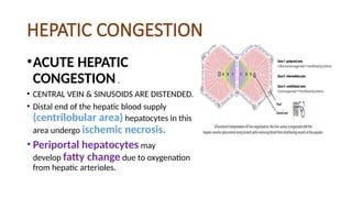 HEPATIC CONGESTION
•ACUTE HEPATIC
CONGESTION.
• CENTRAL VEIN & SINUSOIDS ARE DISTENDED.
• Distal end of the hepatic blood supply
(centrilobular area) hepatocytes in this
area undergo ischemic necrosis.
• Periportal hepatocytes may
develop fatty change due to oxygenation
from hepatic arterioles.
 