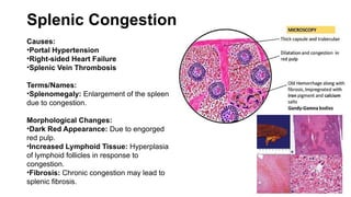Splenic Congestion
Causes:
•Portal Hypertension
•Right-sided Heart Failure
•Splenic Vein Thrombosis
Terms/Names:
•Splenomegaly: Enlargement of the spleen
due to congestion.
Morphological Changes:
•Dark Red Appearance: Due to engorged
red pulp.
•Increased Lymphoid Tissue: Hyperplasia
of lymphoid follicles in response to
congestion.
•Fibrosis: Chronic congestion may lead to
splenic fibrosis.
 
