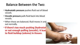 Balance Between the Two:
• Hydrostatic pressure pushes fluid out of blood
vessels.
• Oncotic pressure pulls fluid back into blood
vessels.
• When these are balanced, fluid moves in and
out normally.
• If there’s too much pushing (hydrostatic)
or not enough pulling (oncotic), it leads
to fluid buildup (edema) in tissues.
 