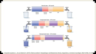 Esqueda-Liquidano, L., & Loo-Salomé, S. (2014). Edema cerebral I: fisiopatología, manifestaciones clínicas, diagnóstico y monitoreo neurológico. Med Int Méx, 30, 584-90.
 