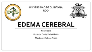 EDEMA CEREBRAL
Neurología
Docente: Daniel de la O Peña
May Lopez Rebeca Aridai
UNIVERSIDAD DE QUINTANA
ROO
 