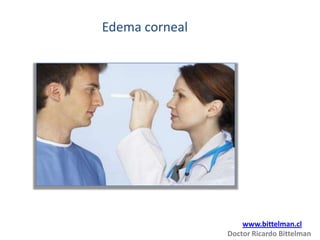 Edema corneal




                    www.bittelman.cl
                Doctor Ricardo Bittelman
 