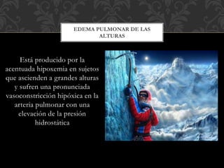 Está producido por la
acentuada hipoxemia en sujetos
que ascienden a grandes alturas
y sufren una pronunciada
vasoconstricción hipóxica en la
arteria pulmonar con una
elevación de la presión
hidrostática
EDEMA PULMONAR DE LAS
ALTURAS
 