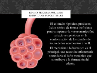 El estímulo hipóxico, producen
óxido nítrico de forma ineficiente
para compensar la vasoconstricción;
variaciones genéticas en la
conformación de los canales de
sodio de los neumocitos tipo II.
El mecanismo hidrostático es el
principal, una reacción inflamatoria
secundaria al daño mecánico que
contribuye a la formación del
edema.
EDEMA SE DESARROLLA EN
INDIVIDUOS SUSCEPTIBLES
 