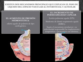 EXISTEN DOS MECANISMOS PRINCIPALES QUE EXPLICAN EL PASO DE
LÍQUIDO DEL ESPACIO VASCULAR AL INTERSTICIAL Y ALVEOLAR
EL AUMENTO DE PRESIÓN
HIDROSTÁTICA:
edema agudo de pulmón de tipo
cardiogénico.
EL INCREMENTO DE
PERMEABILIDAD CAPILAR:
Lesión pulmonar aguda (LPA)
Síndrome de distrés respiratorio agudo
(SDRA).
Según el mecanismo productor y su
enfermedad responsable las implicaciones
terapéuticas y pronosticas son distintas.
 