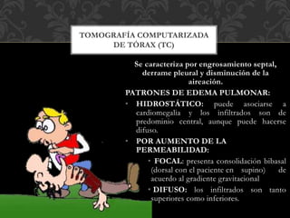 Se caracteriza por engrosamiento septal,
derrame pleural y disminución de la
aireación.
PATRONES DE EDEMA PULMONAR:
• HIDROSTÁTICO: puede asociarse a
cardiomegalia y los infiltrados son de
predominio central, aunque puede hacerse
difuso.
• POR AUMENTO DE LA
PERMEABILIDAD:
• FOCAL: presenta consolidación bibasal
(dorsal con el paciente en supino) de
acuerdo al gradiente gravitacional
• DIFUSO: los infiltrados son tanto
superiores como inferiores.
TOMOGRAFÍA COMPUTARIZADA
DE TÓRAX (TC)
 