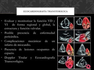 • Evaluar y monitorizar la función VD y
VI de forma regional y global, la
estructura y función valvular.
• Posible presencia de enfermedad
pericárdica.
• Complicaciones mecánicas de un
infarto de miocardio.
• Presencia de lesiones ocupantes de
espacio.
• Doppler Tisular y Ecocardiografía
Transesofágica.
ECOCARDIOGRAFÍA TRANSTORÁCICA
 