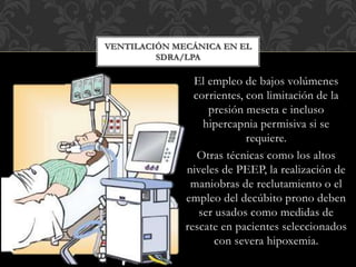 El empleo de bajos volúmenes
corrientes, con limitación de la
presión meseta e incluso
hipercapnia permisiva si se
requiere.
Otras técnicas como los altos
niveles de PEEP, la realización de
maniobras de reclutamiento o el
empleo del decúbito prono deben
ser usados como medidas de
rescate en pacientes seleccionados
con severa hipoxemia.
VENTILACIÓN MECÁNICA EN EL
SDRA/LPA
 