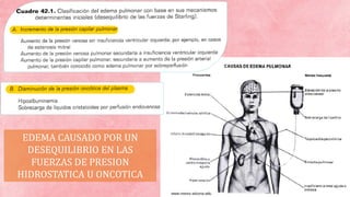 EDEMA CAUSADO POR UN
DESEQUILIBRIO EN LAS
FUERZAS DE PRESION
HIDROSTATICA U ONCOTICA
 