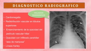 DIAGNO STICO RADIO GRAF ICO
• Cardiomegalia
• Redistribución vascular en lóbulos
superiores
• Ensanchamiento de la opacidad del
pedículo vascular hiliar
• Opacidad con infiltrado parahiliar
“alas de mariposa”
• Líneas Kerley
HALLAZGOS
RADIOGRAFICOS
 