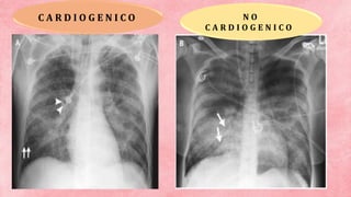 C A R D I O G E N I C O N O
C A R D I O G E N I C O
 