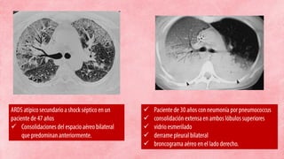 





 