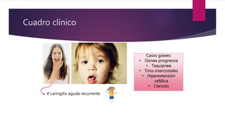 Cuadro clínico
≠ Laringitis aguda recurrente
Casos graves:
• Disnea progresiva
• Taquipnea
• Tiros intercostales
• Hiperextensión
cefálica
• Cianosis
 
