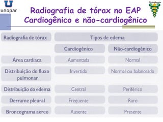 Radiografia de tórax no EAPRadiografia de tórax no EAP
Cardiogênico e nãoCardiogênico e não--cardiogênicocardiogênico
 